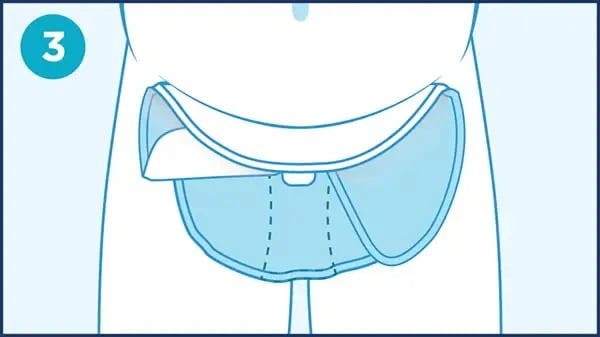 QC_steps_bariatric_3